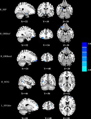 Cerebral blood flow network differences correlated with  - Frontiers